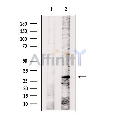 PZR Antibody - Western blot analysis of extracts from Mouse  brain, using PZR Antibody.