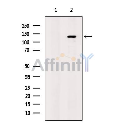 TIE2 Antibody - Western blot analysis of extracts from Mouse  liver, using Tie2 Antibody.