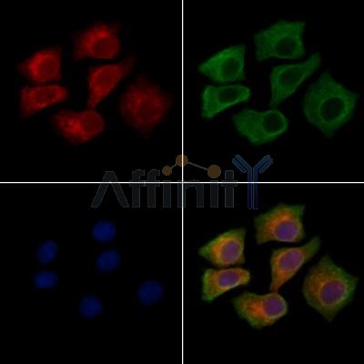 TIE2 Antibody - AF7848 staining Hela cells by IF/ICC.