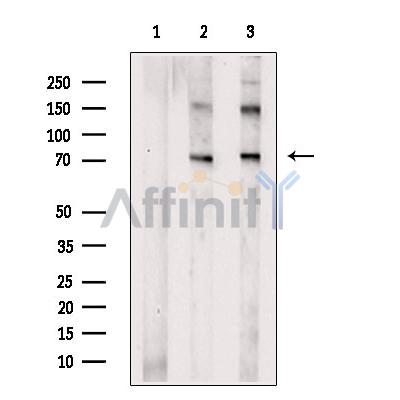 DNAJC2/MPP11 Antibody - Western blot analysis of extracts from various samples, using DNAJC2/MPP11 Antibody.
