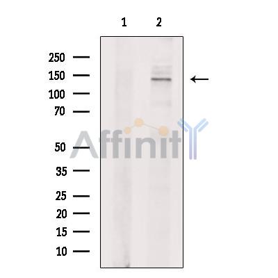 USP40 Antibody - Western blot analysis of extracts from A431 cells, using USP40 Antibody.
