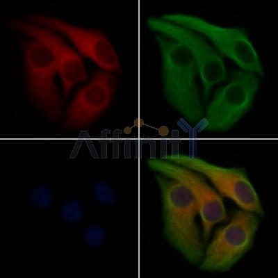 PADI2 Antibody - DF12015 staining Hela cells by IF/ICC.