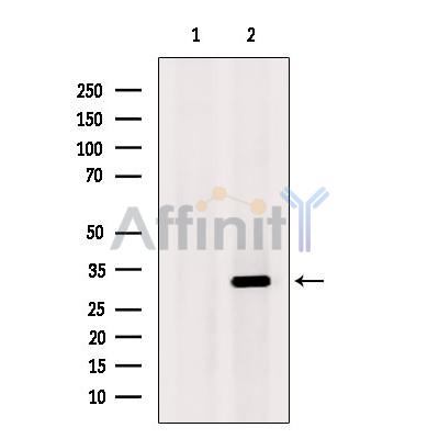 CHMP2A Antibody - Western blot analysis of extracts from EC304 cells, using CHMP2A Antibody.