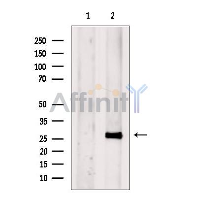 ETFB Antibody - Western blot analysis of extracts from Rat  brain, using ETFB Antibody.