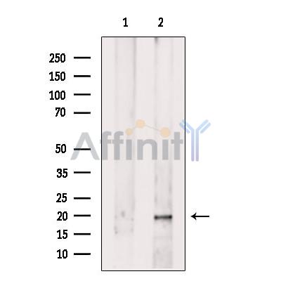 UQCRFS1 Antibody - Western blot analysis of extracts from Hela cells, using UQCRFS1 Antibody.