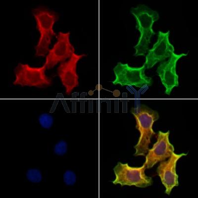 RND3 Antibody - DF12311 staining Hela cells by IF/ICC.