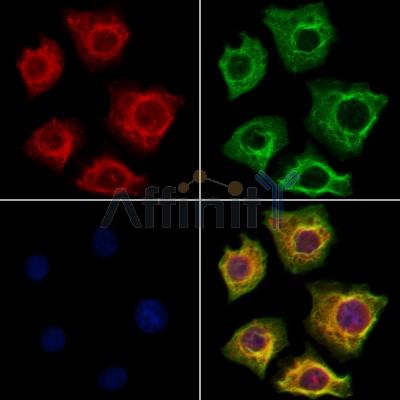 TRBP Antibody - DF12336 staining Hela cells by IF/ICC.