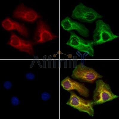 UQCRC1 Antibody - DF12338 staining Hela cells by IF/ICC.