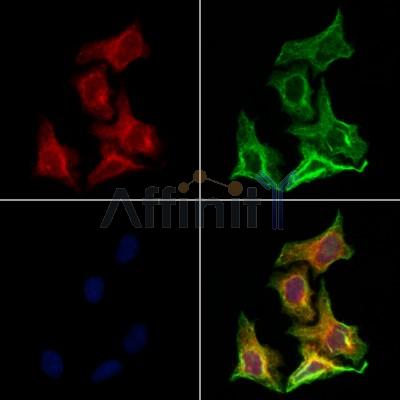 ASRGL1 Antibody - DF12352 staining Hela cells by IF/ICC.