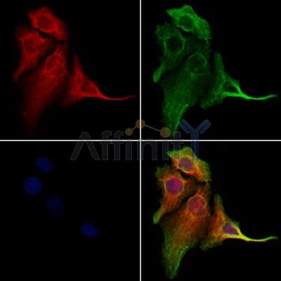 CALCOCO2 Antibody - DF12360 staining Hela cells by IF/ICC.