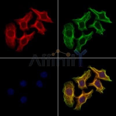 DNAJC19 Antibody - DF12384 staining Hela cells by IF/ICC.