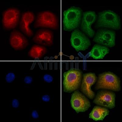 ETFA Antibody - DF12394 staining Hela cells by IF/ICC.