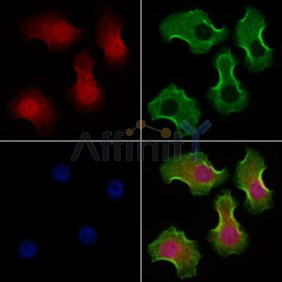 PHF17 Antibody - DF12451 staining Hela cells by IF/ICC.
