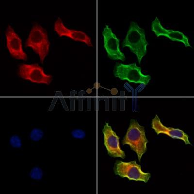 PIK3IP1 Antibody - DF12453 staining Hela cells by IF/ICC.