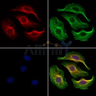 PTP4A1/PRL1 Antibody - DF12458 staining Hela cells by IF/ICC.