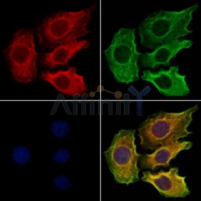 SLC13A2 Antibody - DF12475 staining Hela cells by IF/ICC.