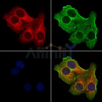 TIMM9 Antibody - DF12487 staining Hela cells by IF/ICC.