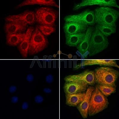 VPS11 Antibody - DF12500 staining Hela cells by IF/ICC.