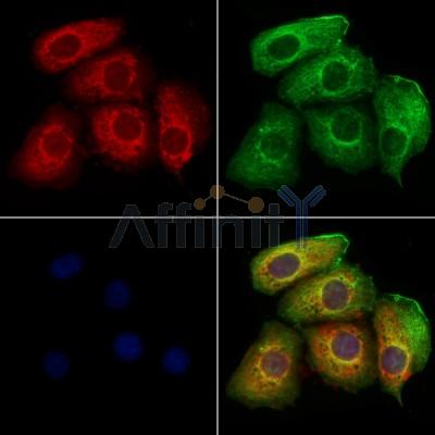 WSB1 Antibody - DF12505 staining Hela cells by IF/ICC.