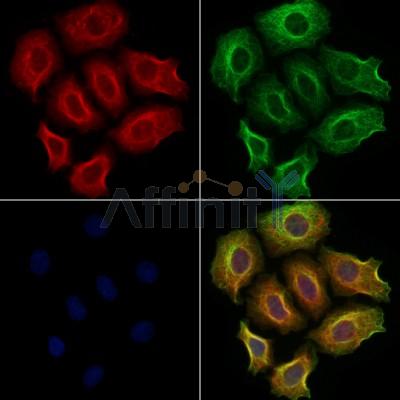 ZFYVE16 Antibody - DF12507 staining Hela cells by IF/ICC.