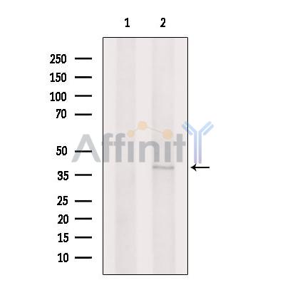 DCUN1D5 Antibody - Western blot analysis of extracts from EC304 cells, using DCUN1D5 Antibody.