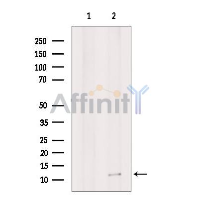 G0S2 Antibody - Western blot analysis of extracts from Hela cells, using G0S2 Antibody.