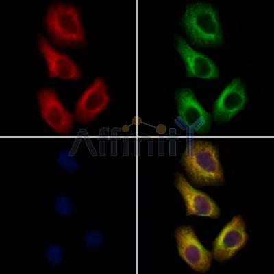 NKCC2 Antibody - DF12671 staining Hela cells by IF/ICC.