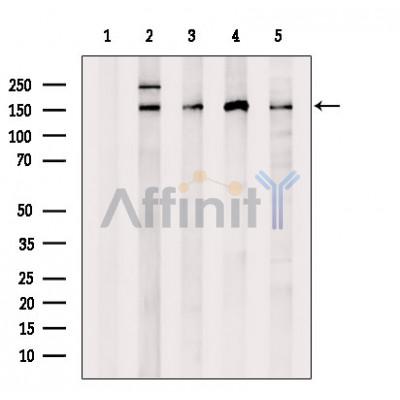 PHLPPL Antibody - Western blot analysis of extracts from various samples, using PHLPPL Antibody.