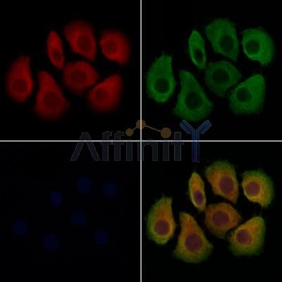 TACO1/CCDC44 Antibody - DF12763 staining Hela cells by IF/ICC.