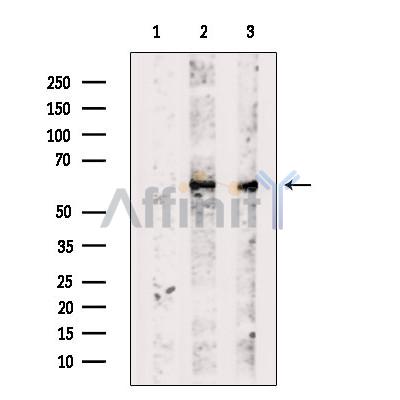 TBCE Antibody - Western blot analysis of extracts from various samples, using TBCE Antibody.