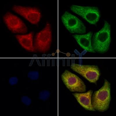 TBCE Antibody - DF12766 staining Hela cells by IF/ICC.
