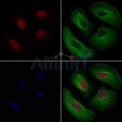 ZNF143 Antibody - DF12802 staining Hela cells by IF/ICC.