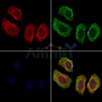 AFAP1 Antibody - DF12812 staining Hela cells by IF/ICC.