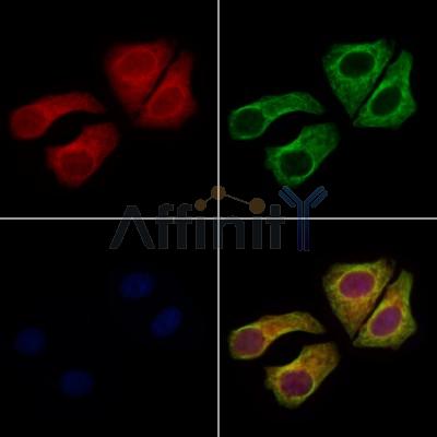 ARL5B Antibody - DF12834 staining Hela cells by IF/ICC.
