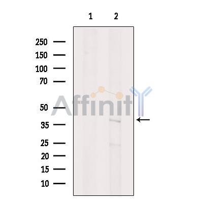 ASPA Antibody - Western blot analysis of extracts from COS-7, using ASPA Antibody.
