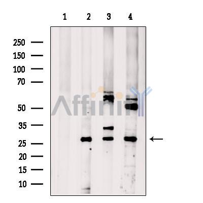 CNOT8 Antibody - Western blot analysis of extracts from various samples, using CNOT8 Antibody.