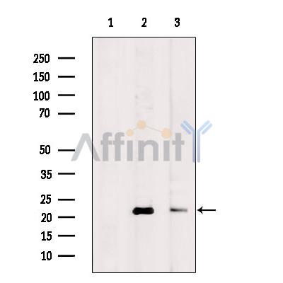 CSRP2 Antibody - Western blot analysis of extracts from various samples, using CSRP2 Antibody.
