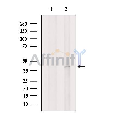 DDAH2 Antibody - Western blot analysis of extracts from Hela cells, using DDAH2 Antibody.