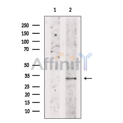 DIO2 Antibody - Western blot analysis of extracts from Rat  ovary, using DIO2 Antibody.