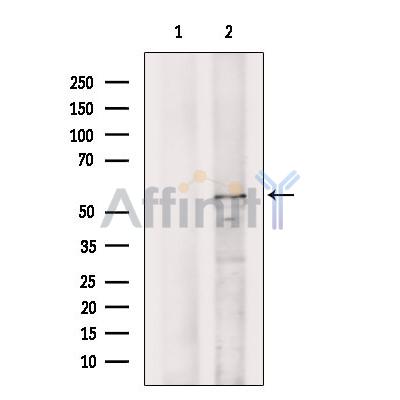 DNAJC7 Antibody - Western blot analysis of extracts from Hela cells, using DNAJC7 Antibody.