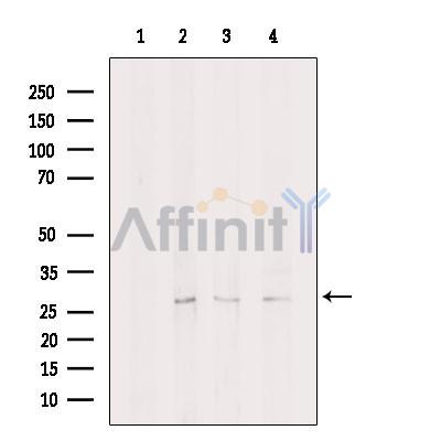 EIF4H Antibody - Western blot analysis of extracts from various samples, using EIF4H Antibody.