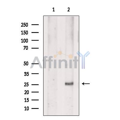 EVI2A Antibody - Western blot analysis of extracts from Mouse  kidney, using EVI2A Antibody.
