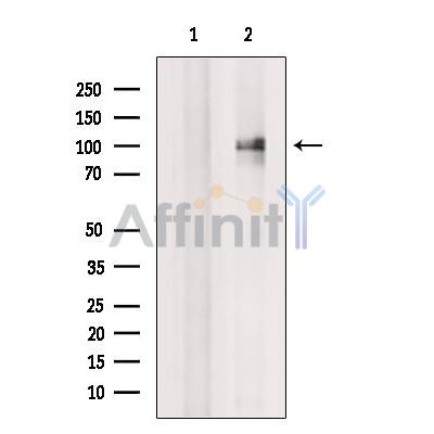 EXOC6 Antibody - Western blot analysis of extracts from Rat  brain, using EXOC6 Antibody.