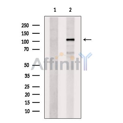 EXOC6 Antibody - Western blot analysis of extracts from Huvec, using EXOC6 Antibody.