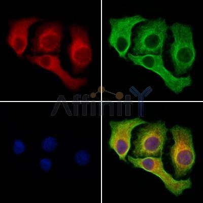 beta COP Antibody - DF13220 staining Hela cells by IF/ICC.