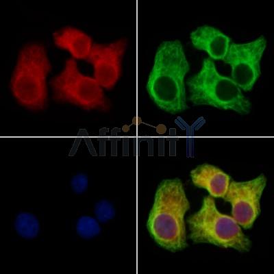 Clathrin heavy chain Antibody - DF13223 staining Hela cells by IF/ICC.