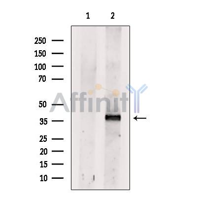 Dectin-1 Antibody - Western blot analysis of extracts from Hela cells, using Dectin-1.