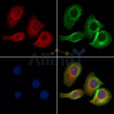 cbx7 Antibody - DF13257 staining Hela cells by IF/ICC.