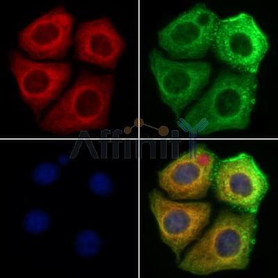 Mannosidase II Antibody - DF13260 staining HepG2 cells by IF/ICC.
