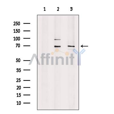 TDP1 Antibody - Western blot analysis of extracts from various samples, using TDP1 Antibody.